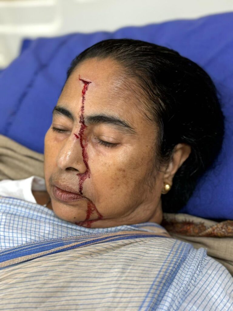మమతకు తీవ్ర గాయం